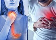 New study: Acid reflux raises heart attack risk by a third