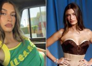 Hailey Bieber’s Face Transformation Revealed